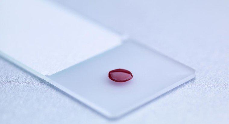 ¿Qué es una prueba de sangre LDH?