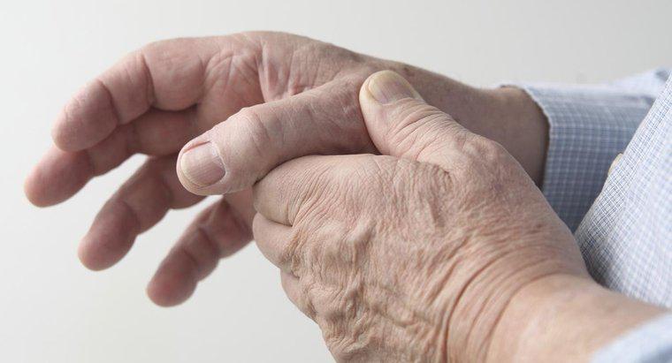 ¿Cuál es el mejor tratamiento para ayudar a las manos artríticas?