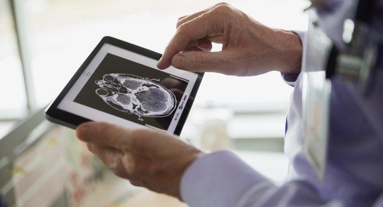 ¿Cuál es el pronóstico de un paciente con un tumor en el lóbulo frontal?