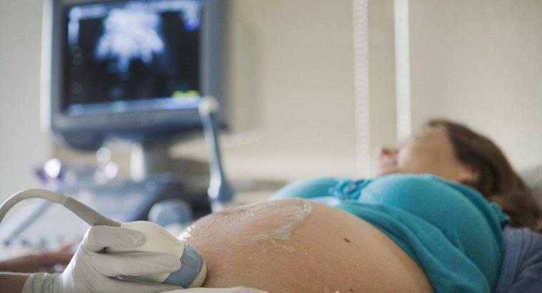 ¿Cuándo un ultrasonido mostrará el género de un bebé?