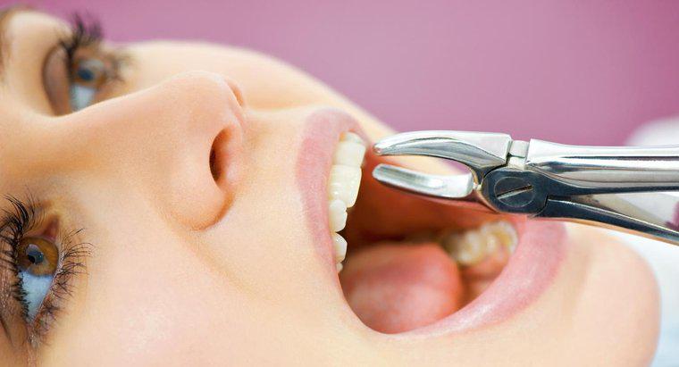 ¿Cuánto tiempo demora una cura en la toma de corriente después de extraer un diente?