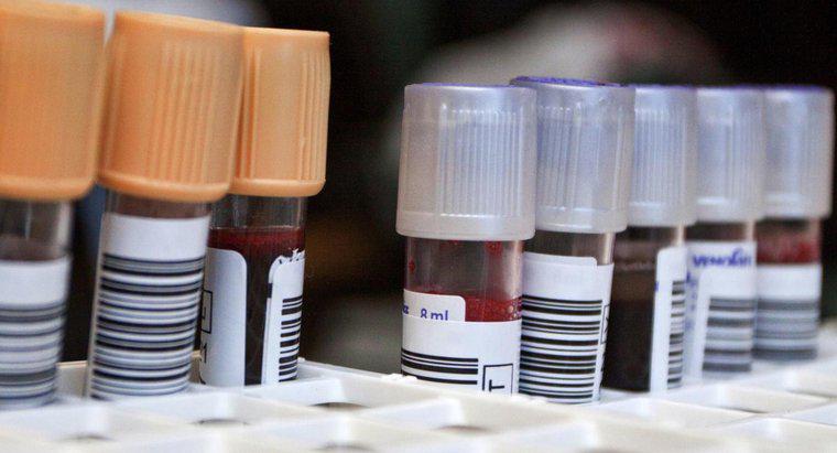 ¿Qué es un análisis de sangre de neutrófilos?