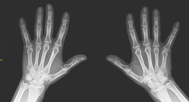 ¿Cómo se llaman todos los huesos de dedos y dedos de los pies?