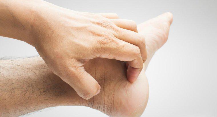 ¿Qué causa picazón en las manos y los pies?
