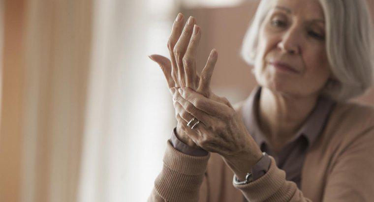 ¿Cómo se cura la artritis?