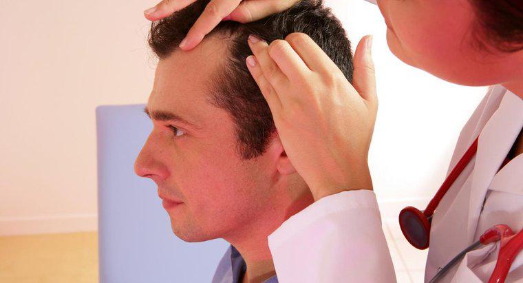 ¿Qué tipo de médico trata la pérdida de cabello?