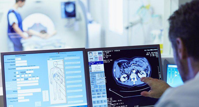 ¿Cuánto tiempo se tarda en obtener los resultados de la tomografía computarizada?