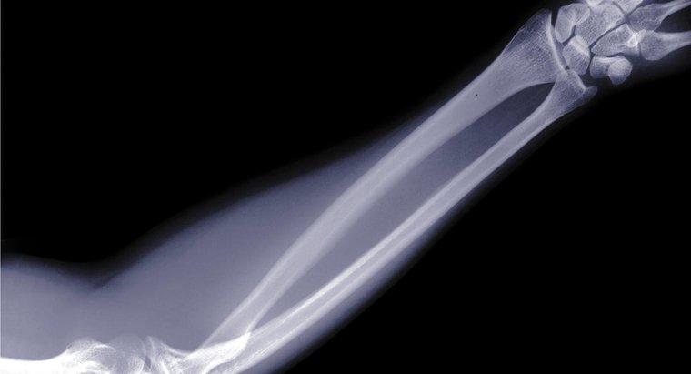 ¿Cuáles son los nombres de los huesos en el brazo humano?