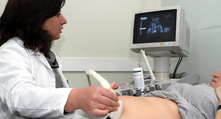 ¿Qué es un embarazo tubárico?