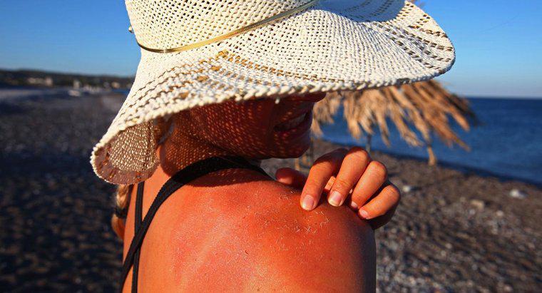 ¿Cómo afectan los rayos UV a las personas?