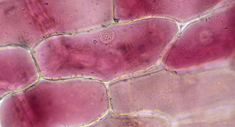 ¿Qué efecto tiene el yodo en las células de la cebolla?
