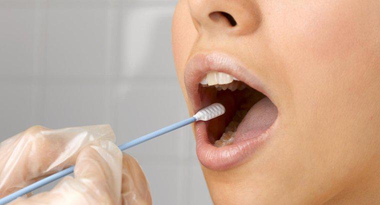 ¿Qué tan exactas son las pruebas de drogas de hisopo bucal?