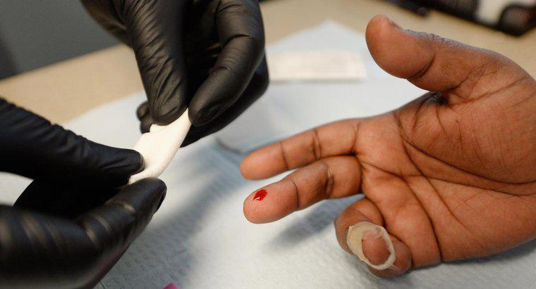 ¿Cuánto tiempo tarda el VIH en aparecer en las pruebas?