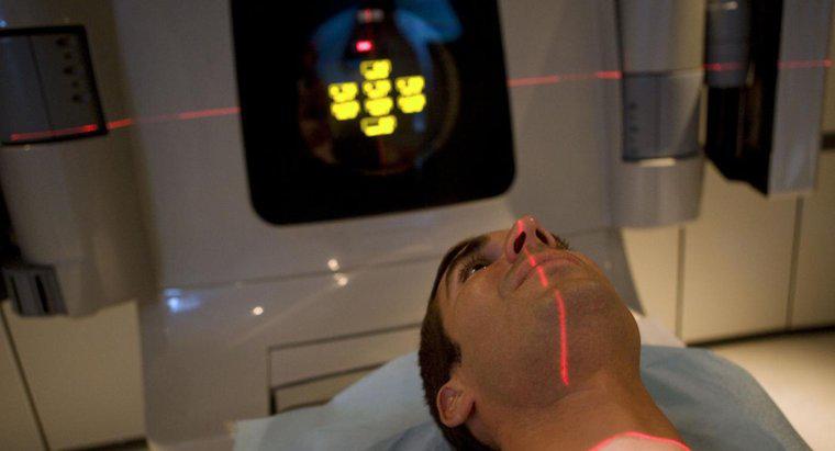 ¿Cuáles son los efectos de la radioterapia?