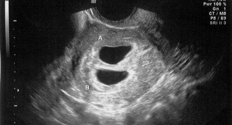 ¿Puede un ultrasonido detectar un embarazo en 4 semanas?