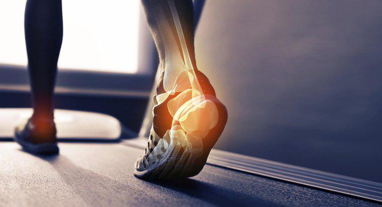 ¿Qué causa un espolón óseo en el talón de tu pie?