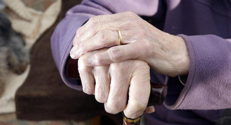 ¿Cómo se diagnostica la artritis en las manos?