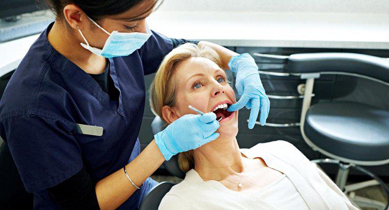 ¿Cuáles son los signos de caries dental?