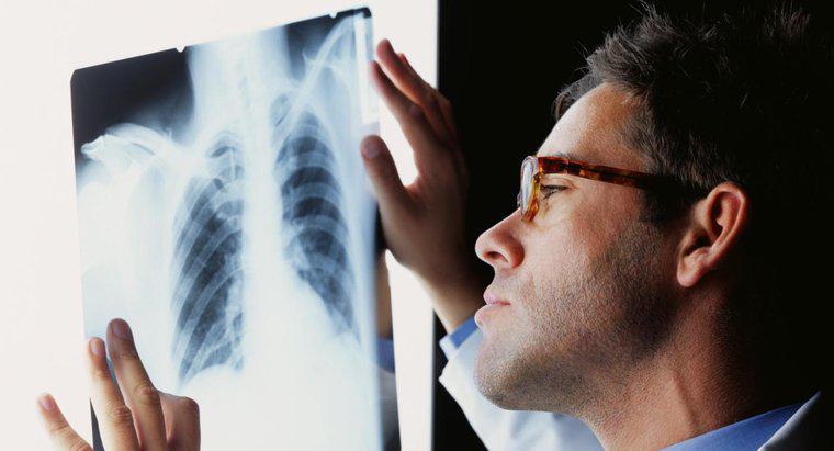 ¿Cómo se trata una infección pulmonar?