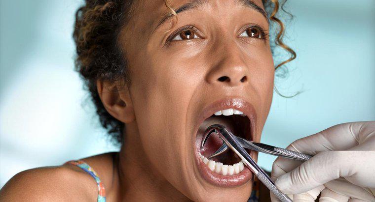 ¿Cómo se trata una infección después de la extracción dental?