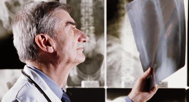¿Cuáles son las desventajas de los rayos X?