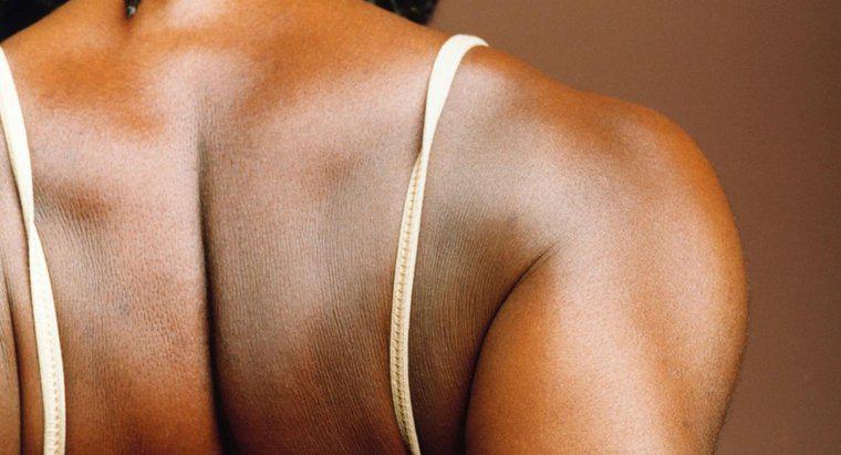 ¿Qué causa el dolor de espalda a lo largo de la lámina del hombro?