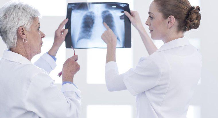 ¿Qué hacen los pulmones en el sistema respiratorio?