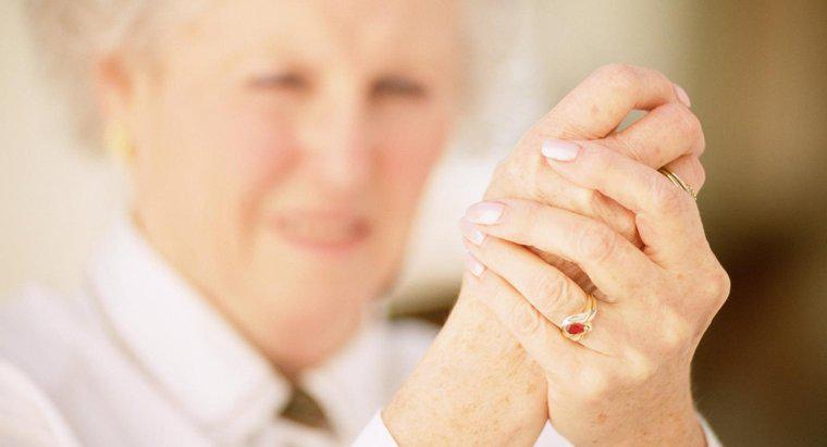 ¿Cuáles son los síntomas de la artritis reumatoide en sus dedos?