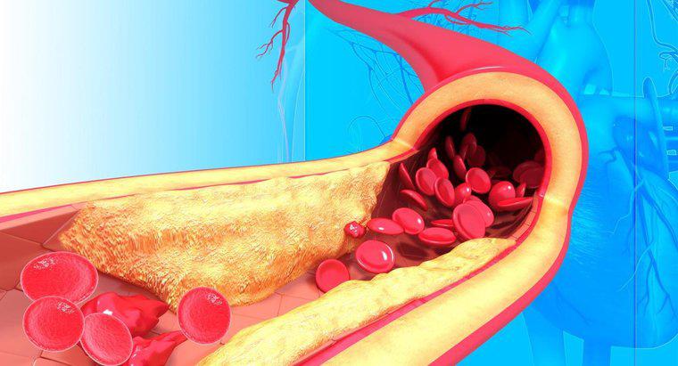 ¿Cuál es la estructura de las arterias?