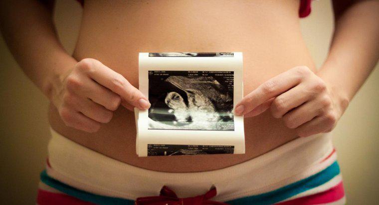 ¿Cuál es el orden correcto de las etapas del desarrollo prenatal?