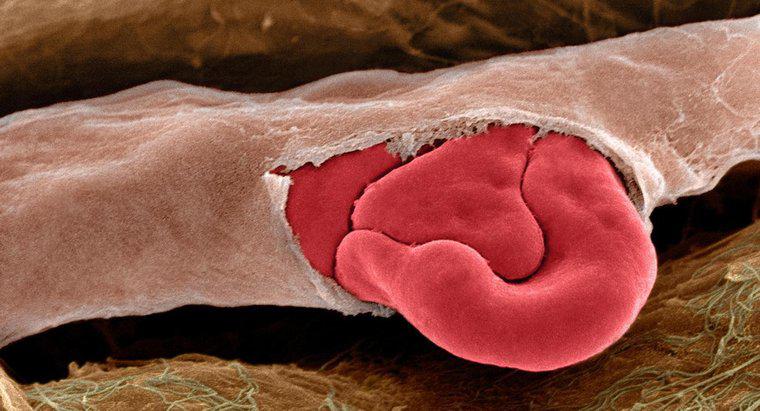 ¿Qué causa que los vasos sanguíneos se rompan?