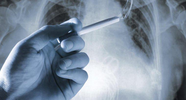 ¿Cuáles son algunos de los síntomas de cáncer de pulmón?