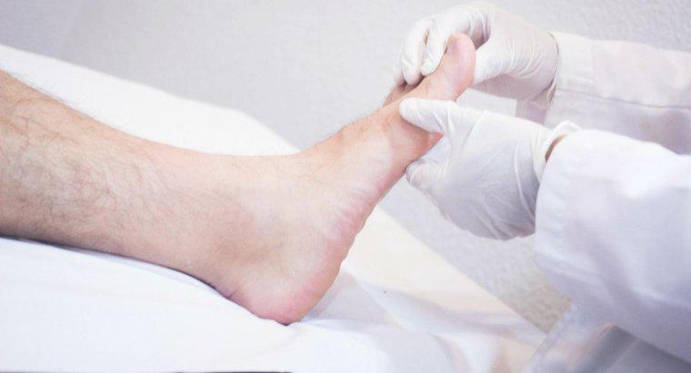 ¿Cuáles son los riesgos para la salud involucrados en los pies hinchados?