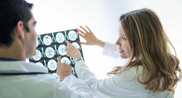 ¿Cuáles son algunos síntomas de un tumor cerebral?