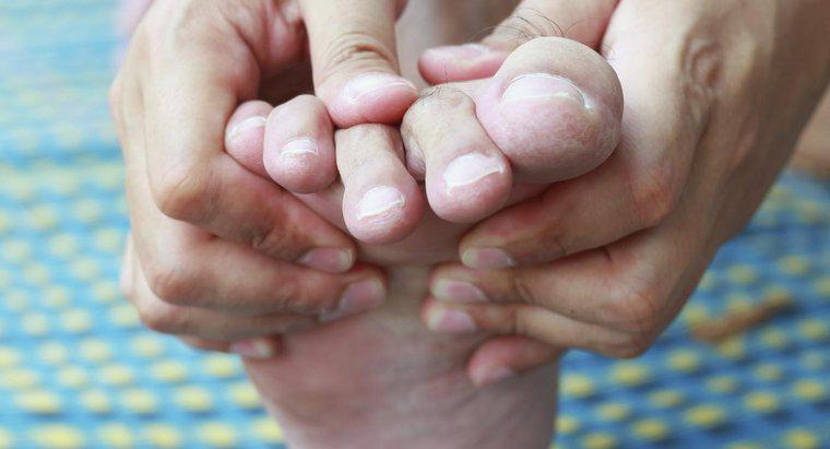 ¿Cómo aliviar el dolor de los callos entre los dedos de los pies?
