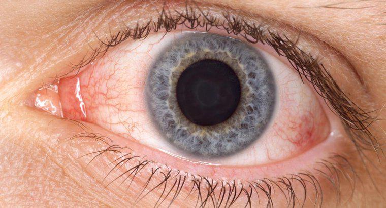¿Cómo ayuda el ácido bórico con el ojo rosado?