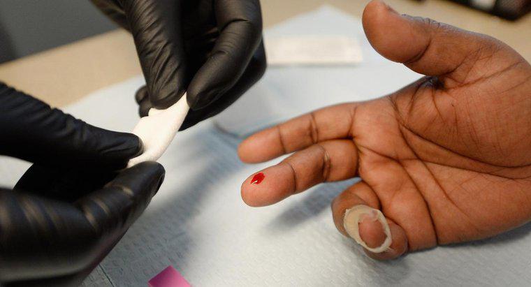 ¿Cuáles son los primeros síntomas del VIH?