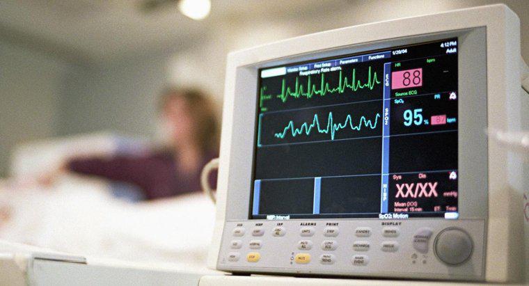¿Qué es un ecocardiograma?