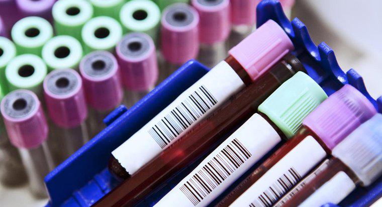 ¿Cuáles son las abreviaturas comunes en un análisis de sangre?