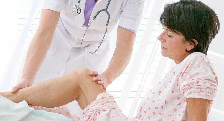 ¿Qué causa el dolor nervioso en la pierna?