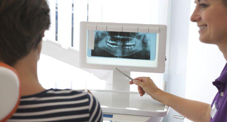 ¿Cuáles son los pros y los contras de los mini implantes dentales?