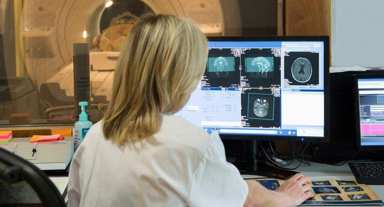 ¿Qué significa una mancha blanca en la RM cerebral?