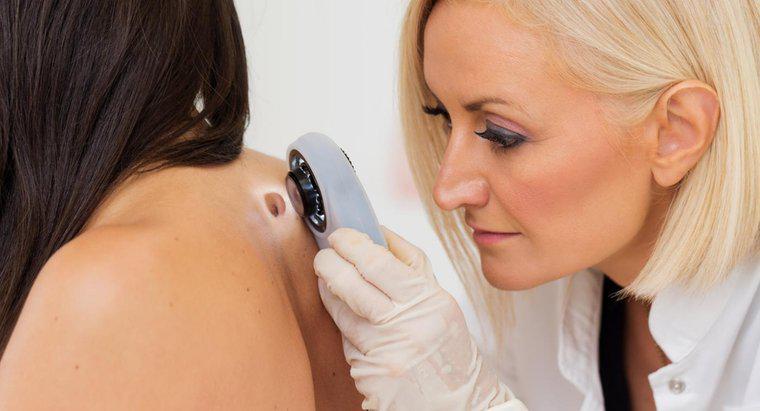 ¿Qué sitios web médicos muestran imágenes de tipos de cáncer de piel?