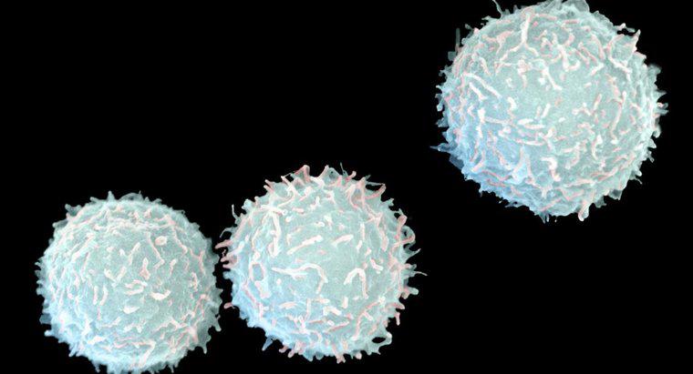 ¿Qué causa el recuento bajo de glóbulos blancos y el recuento absoluto de linfocitos?