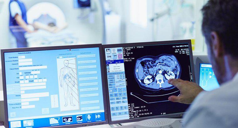 ¿Cuáles son las ventajas y desventajas de las tomografías computarizadas?