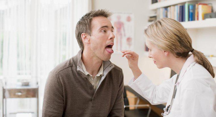 ¿Qué indican las glándulas inflamadas debajo de la lengua?