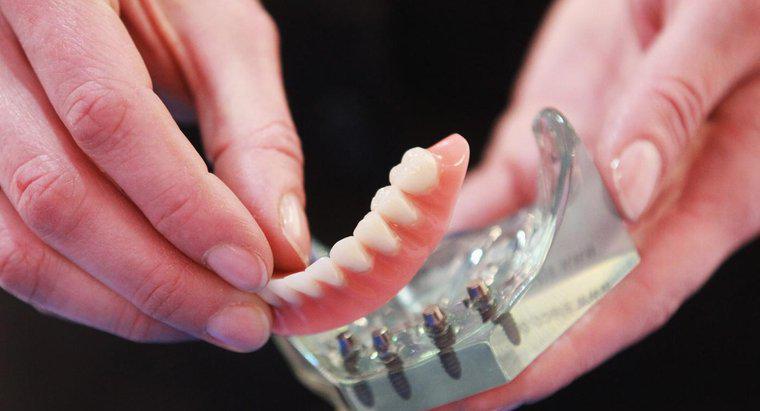 ¿Qué son las dentaduras postizas?
