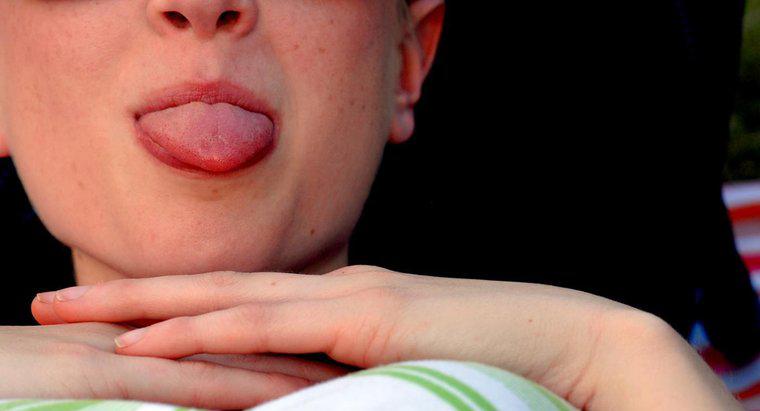 ¿Qué significa tener ampollas debajo de la lengua?