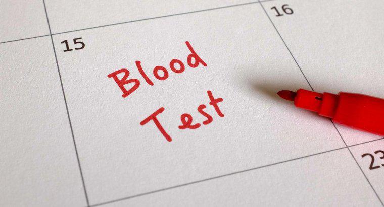 ¿Qué es un análisis de sangre CA 125?