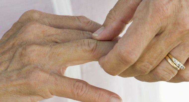 ¿Qué es la artritis de grado 4?